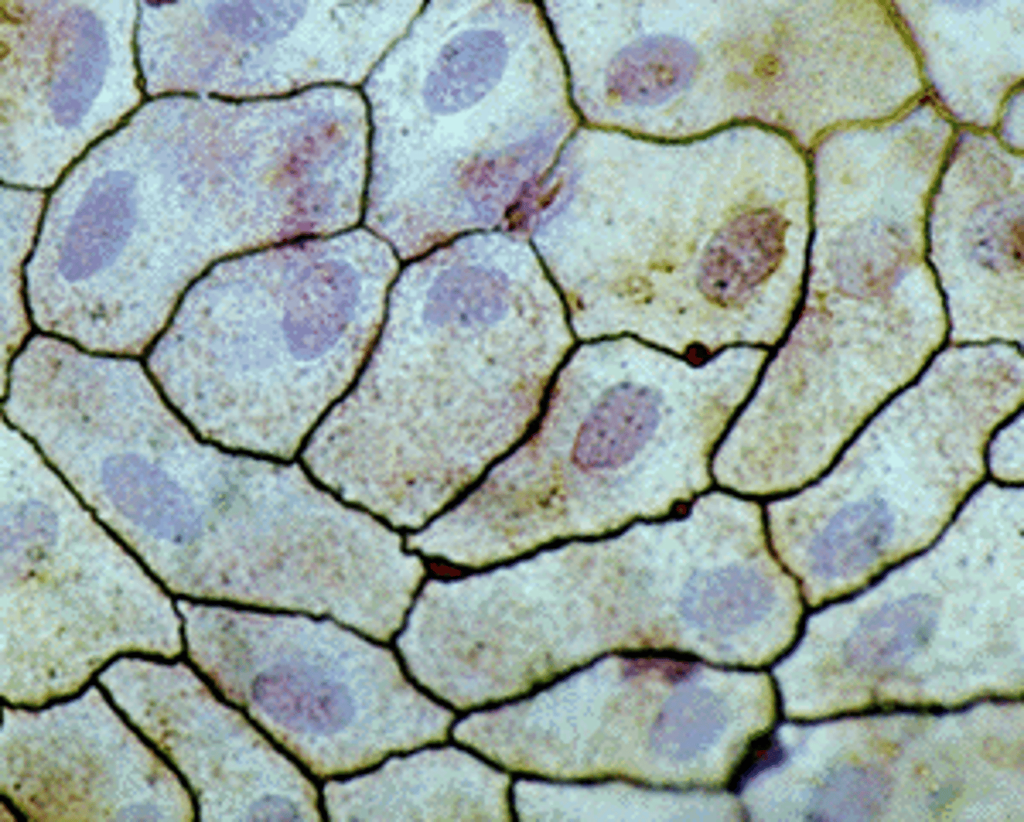 <p>- flat usually found lining surfaces that require smooth flow of fluid <br>found in the; <br>- Alveoli <br>- Lungs</p>