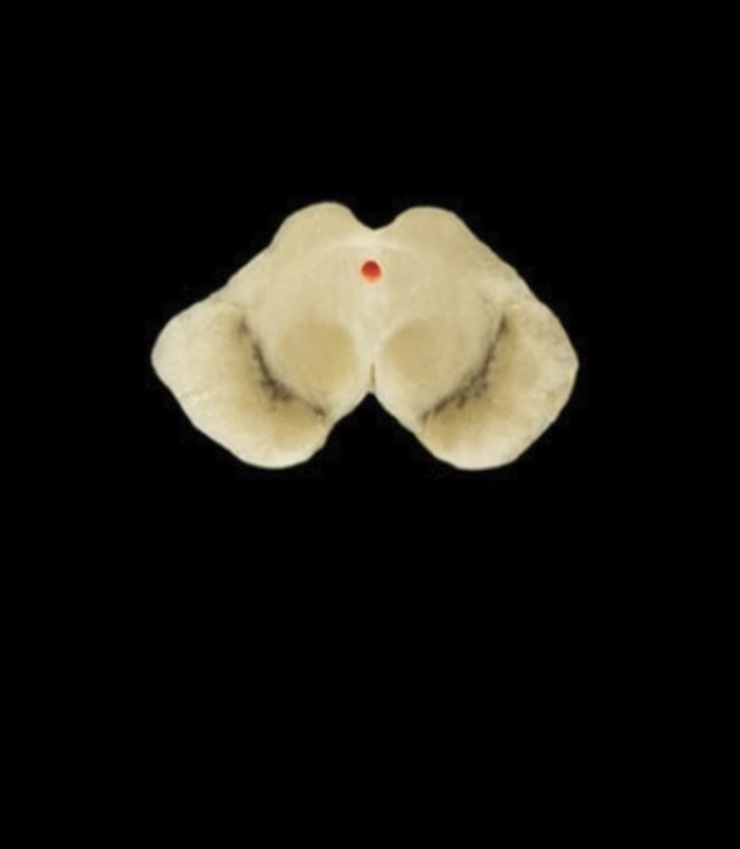 <p>Name this structure</p>