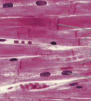 <p>What type of muscle tissue is this?</p>