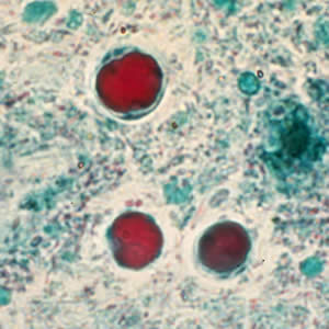 <ul><li><p>multiplies by binary fission</p></li><li><p>3-5 um</p></li><li><p>large vacuole surrounded by several small nuclei</p></li><li><p>can be confused with yeast</p></li><li><p>no troph form, only spherical form seen</p></li></ul><p></p>