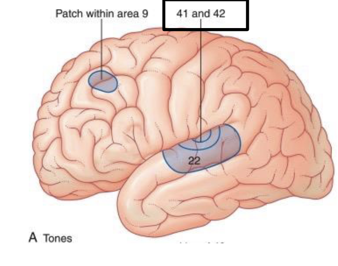 <p>unilateral destruction of primary Broadmann areas of the auditory cortex results in …? what about destruction of both sides?</p>