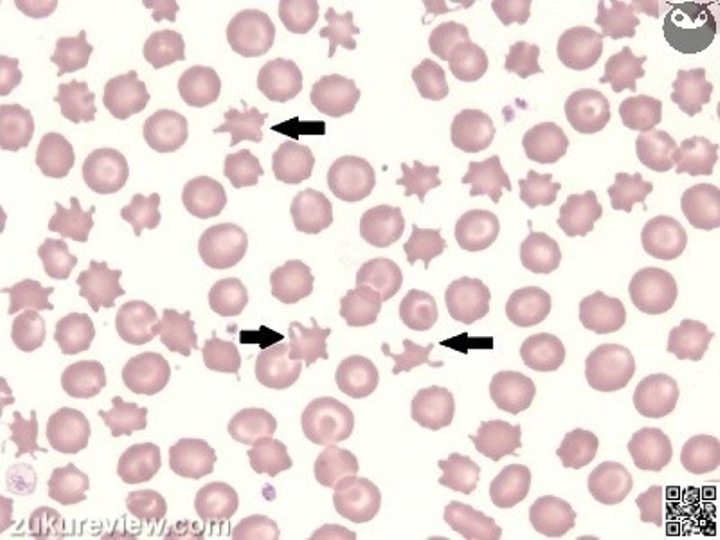 <p>What are red blood cells (RBCs) with multiple irregularly spaced projections called?</p><p>Cornified</p><p>Rouleaux</p><p>Acanthocytes</p><p>Metarubricytes</p><p>Spherocytes</p>