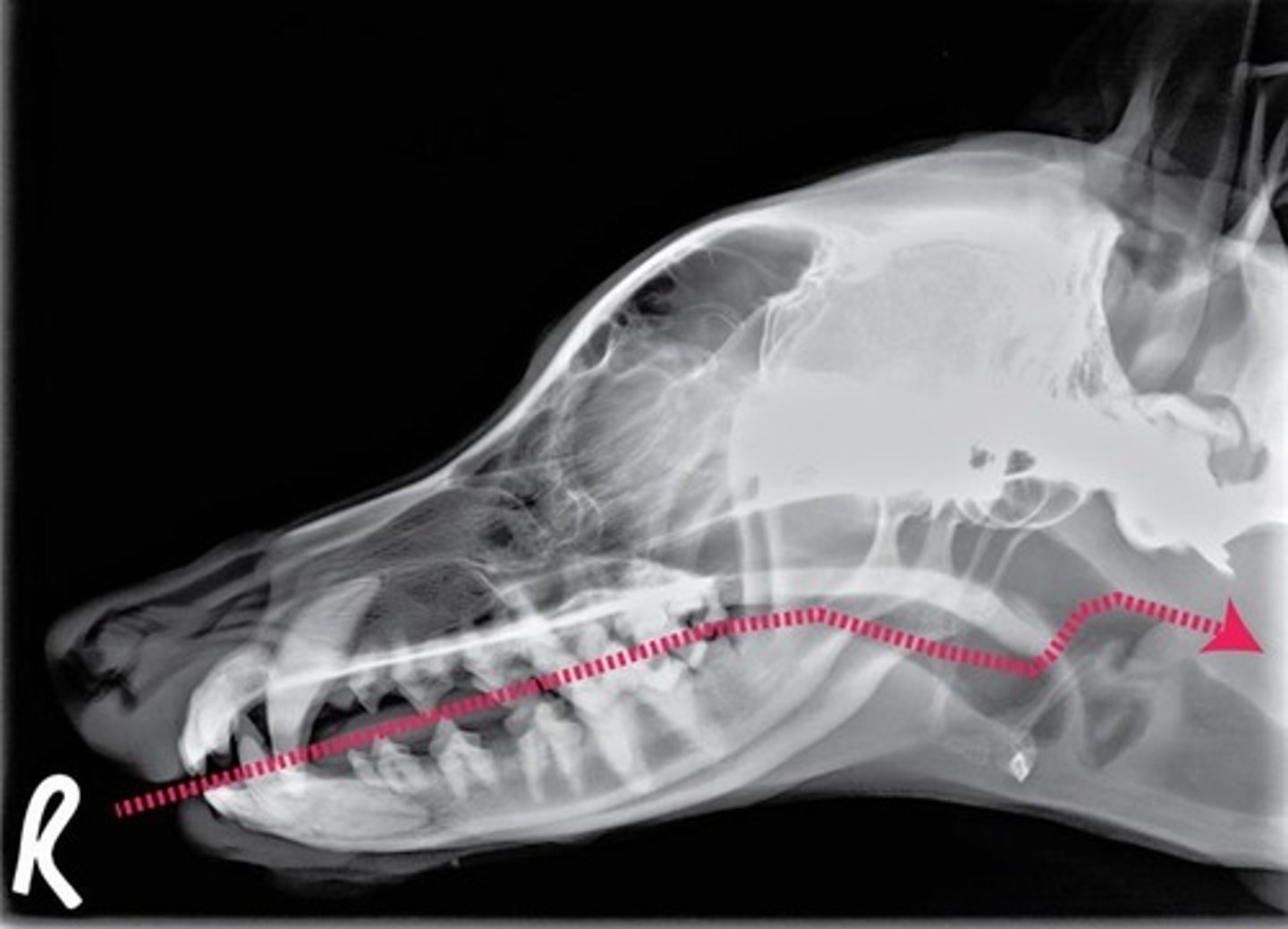 <p>List the major structures you pass through or around, IN ORDER, during intubation of the esophagus.</p>