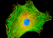 <ol><li><p><span>networks of actin filaments are part of the <strong>cell cortex</strong>, which is the meshwork of membrane associated proteins that supports and strengthens the plasma membrane</span></p><ol><li><p><span>Such networks allows cells to hold and move specialized shapes such as the brush border of microbilli</span></p></li><li><p><span>Actin filaments are also involved in cytokinesis and cell movement</span></p></li></ol></li></ol><p></p>