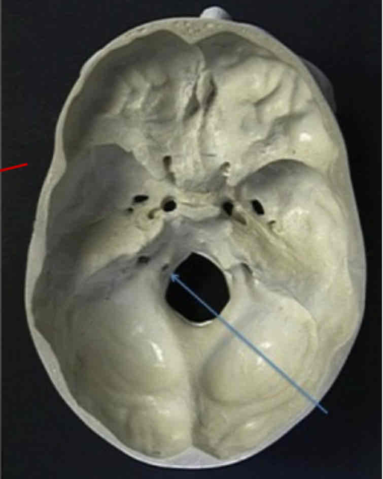 <p><span>What cranial nerve is indicated?</span></p>