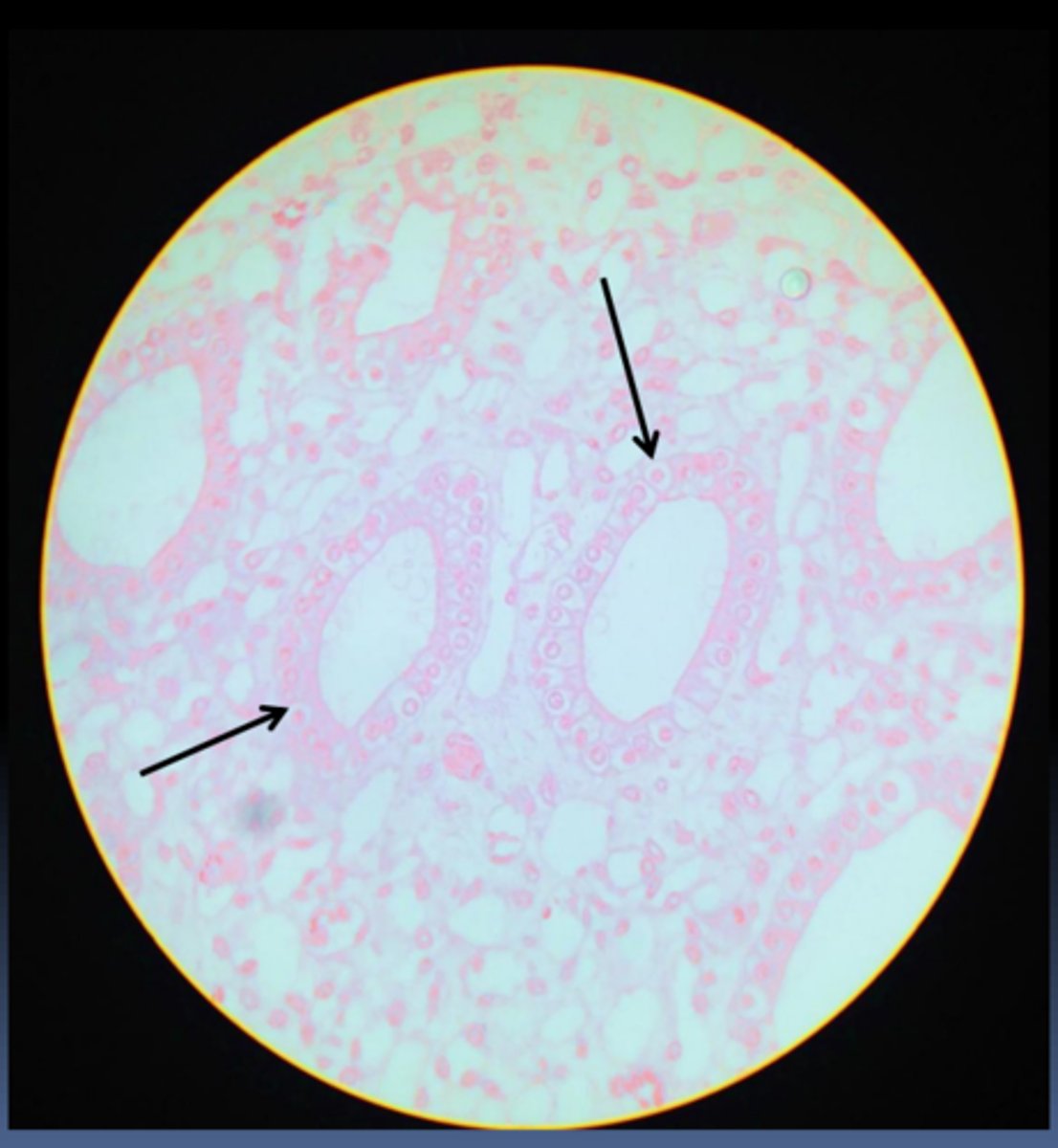 <p>What is this particular subtype?</p>