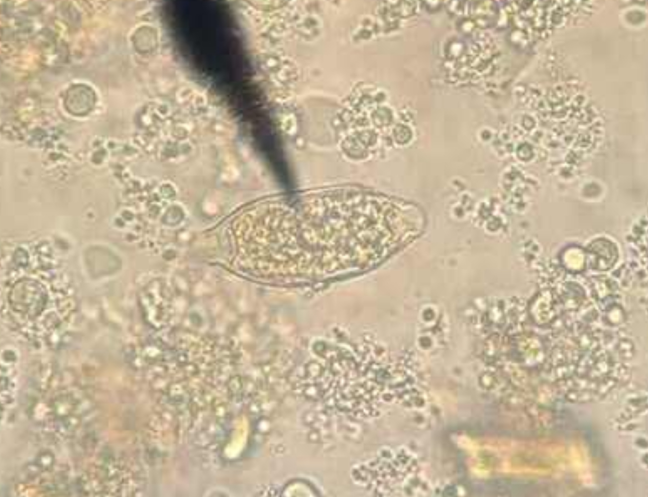 <p>A. stage/form</p><p>B. stain used</p><p>C. distinguishing characteristics</p>