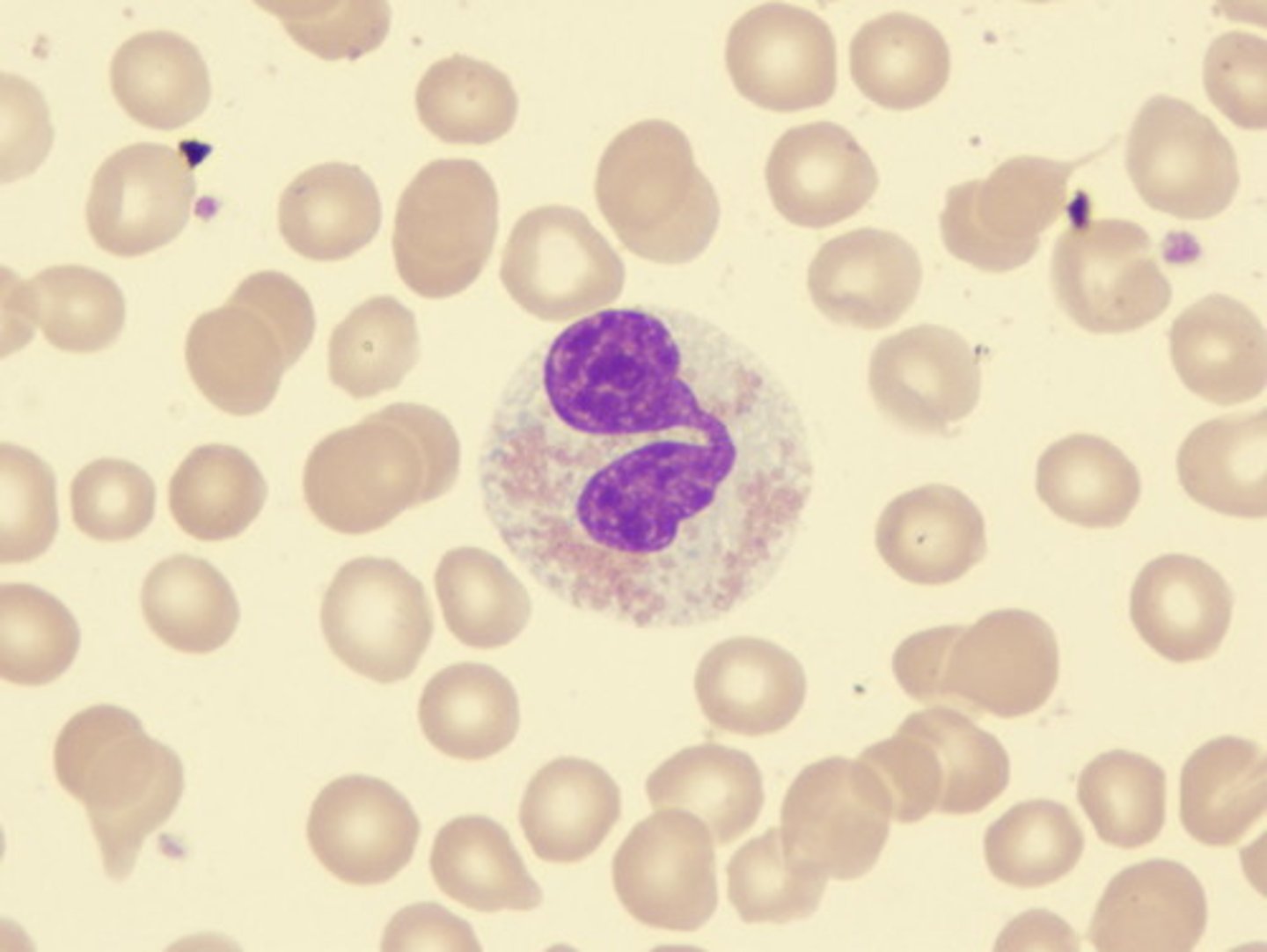 <p>the largest granulocyte</p><p>- has a bilobed nucleus</p><p>----------------------------------</p><p>Eosinophils granules account for 2-5% of WBCs</p><p>-have red-staining, bilobed nuclei</p><p>-Have red to crimson (acidophilic) large, coarse, lysosome-like granules</p><p>-phagocytize cells infected with combat parasites</p><p>-Lessen the severity of allergies by phagocytizing immune complexes and by releasing antihistamines</p>