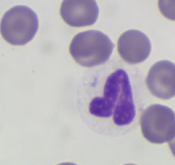 <p>What toxic change has happened in this neutrophil?</p>