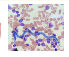 <p>Infective stage of&nbsp;<span>Dirofilaria immitis</span></p>