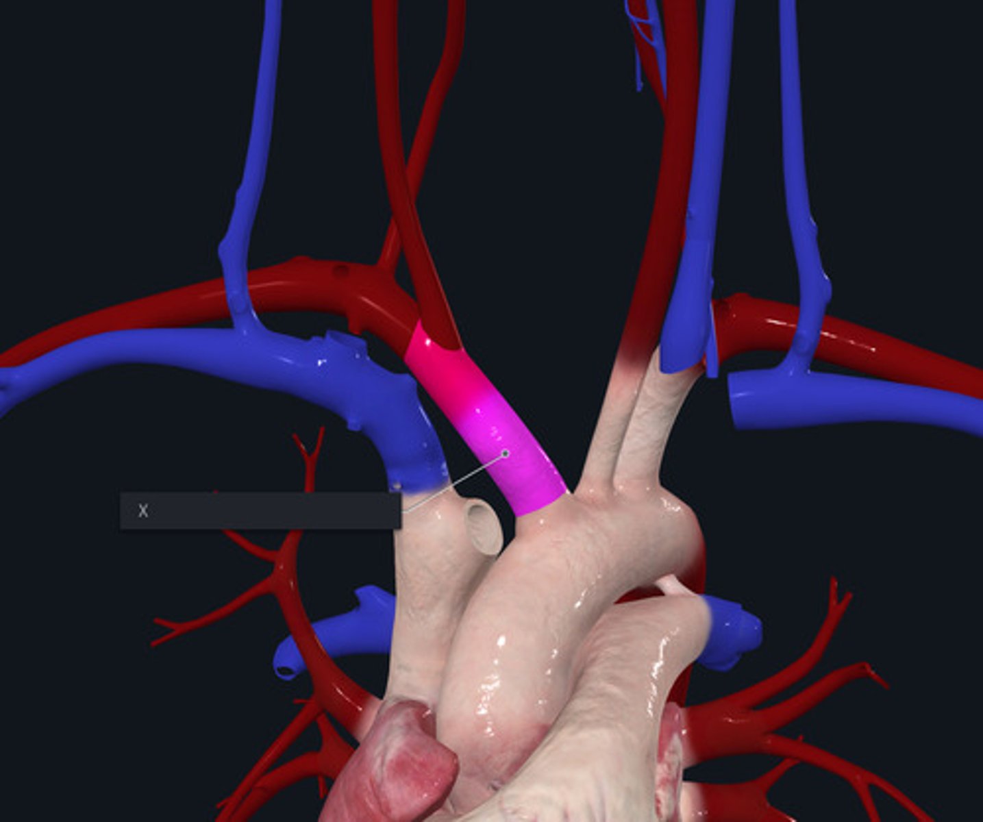 <p>Name the Vessel highlighted pink and marked with the X largest aortic branch</p>
