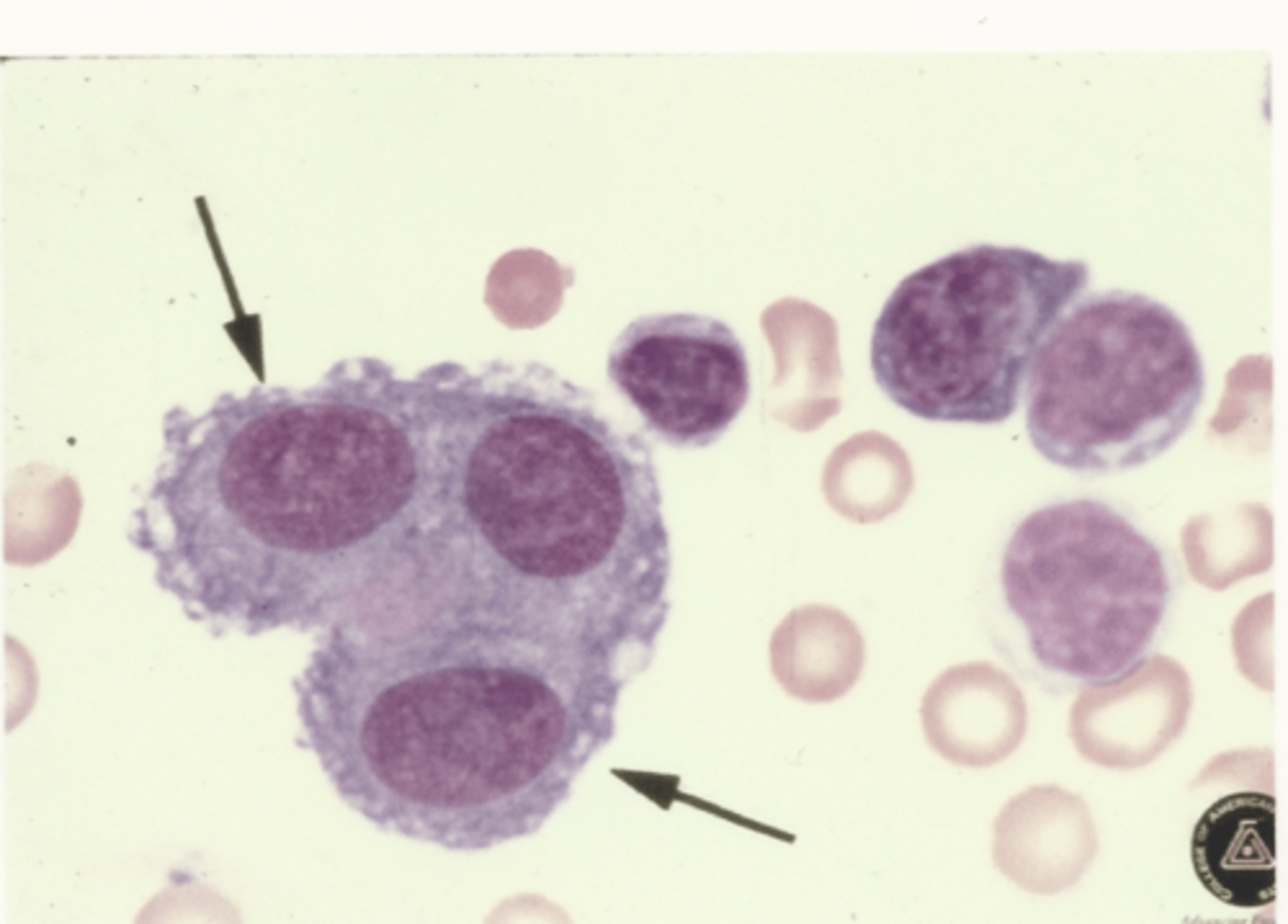 <p>Identify the cells in this body fluid</p>