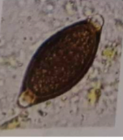 <p>- Medium</p><p>- Lemon shape with 2 polar plugs</p><p>- 2 thick shells</p><p>- Unembryonated</p><p>- Brown</p>