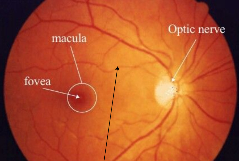 <p>The fovea.</p><p>Cones for normal visual activity. </p><p>Damage is more serious than to peripheral retinal damage. </p>