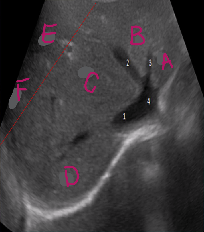 <p>E</p>
