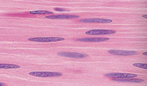 <p>myofilaments arranged in irregular bundles instead of repeating light and dark regions</p>