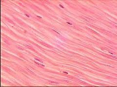 Type: Dense 

Location: Tendons & ligaments

Function: resist tension in one direction