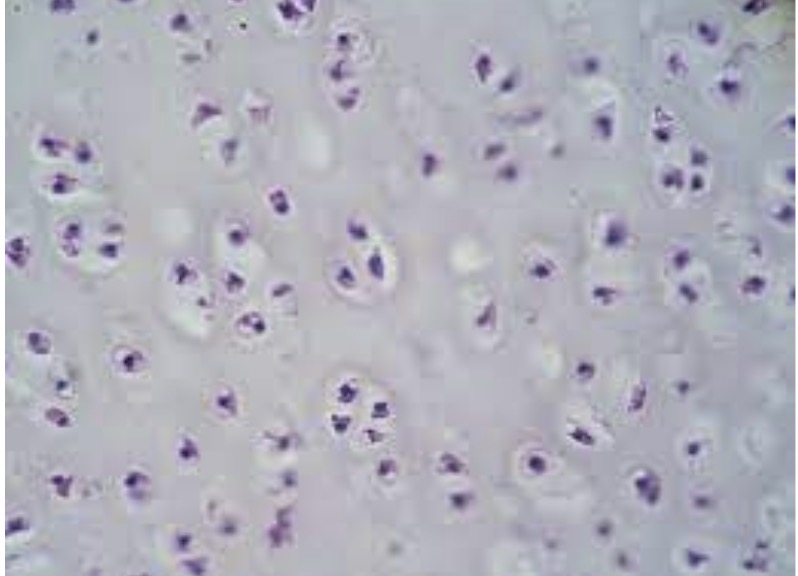 <p>what type?</p>