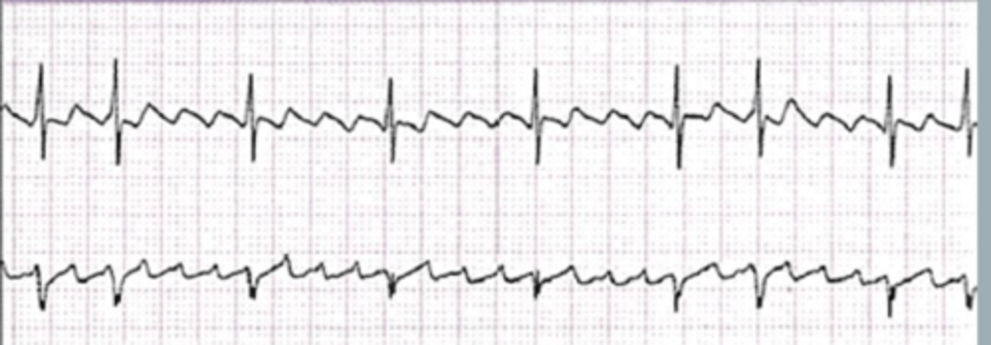<p>Rhythm?</p><p>Management?</p>