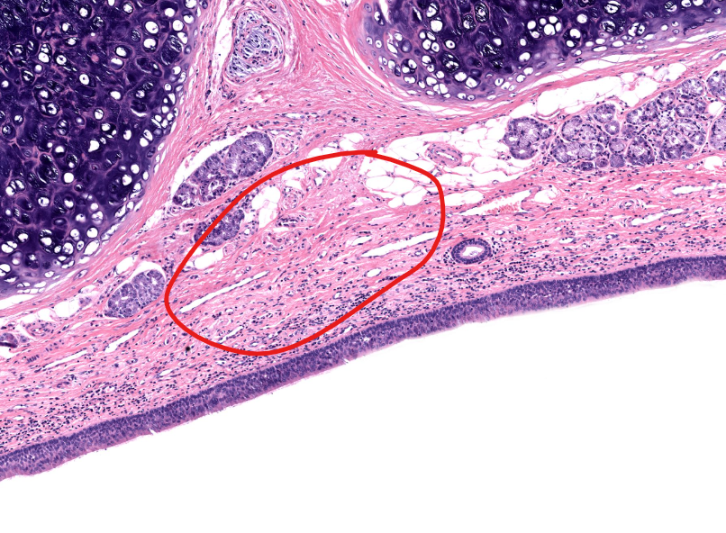 <p>tissue type</p>