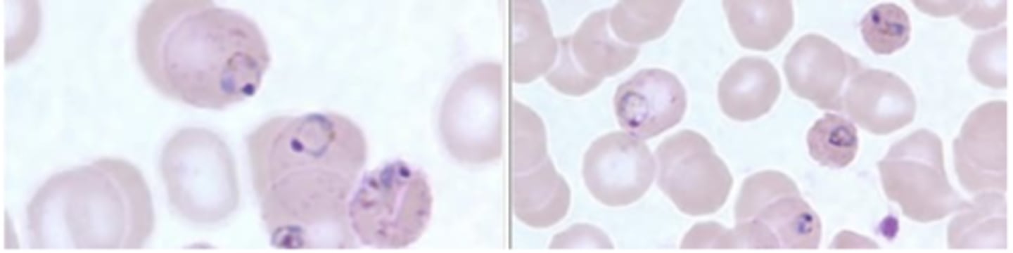 <p>blood smears</p><p>(look for rings within RBC)</p>