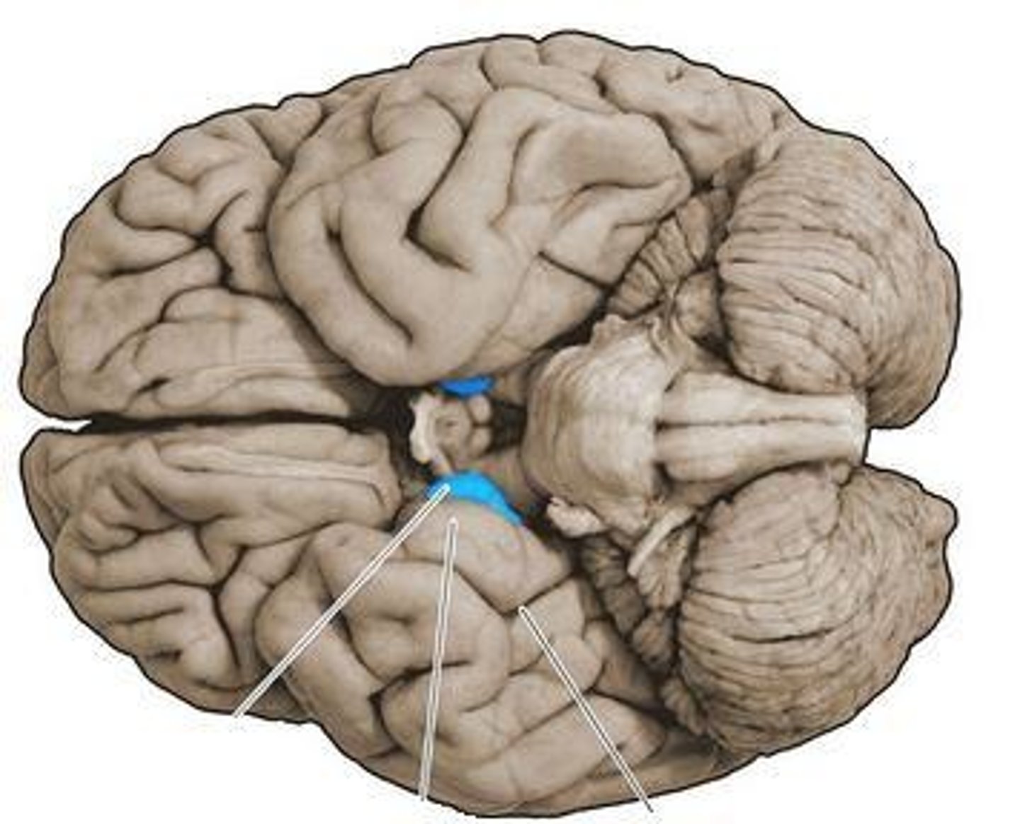 <p>anterior extremity of the parahippocampal gyrus at the temporal lobe</p><p>(medial temporal lobe)</p>