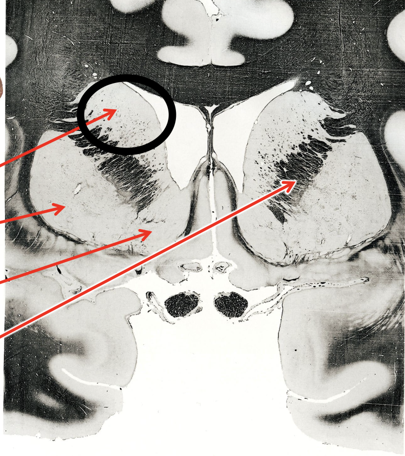 <p>what is the circled region?</p>