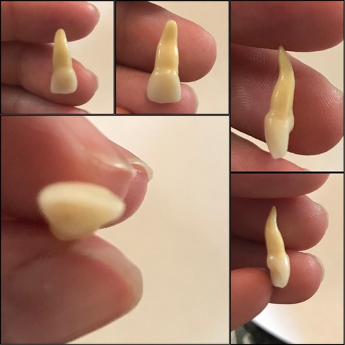 <p>What tooth is this ?</p>