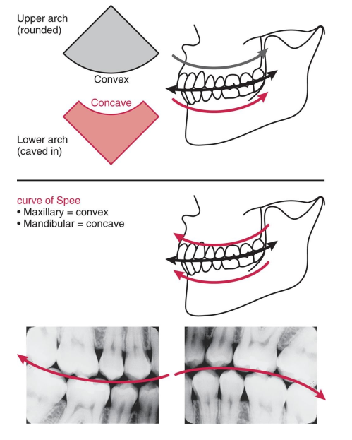 <p>The curve of Spee is the convex nature of the maxilla and the concave nature of the mandible. </p><ul><li><p>it is a useful landmark when mounting bite-wing radiographs. </p></li></ul><p></p>