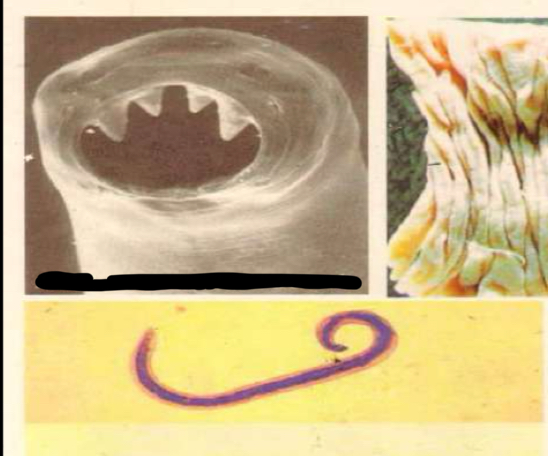 <p>Parasite under microscope?</p>