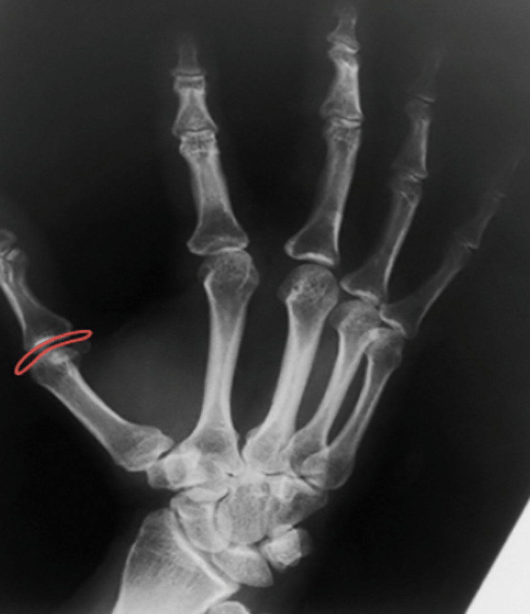 <p>What structure is highlighted?</p>