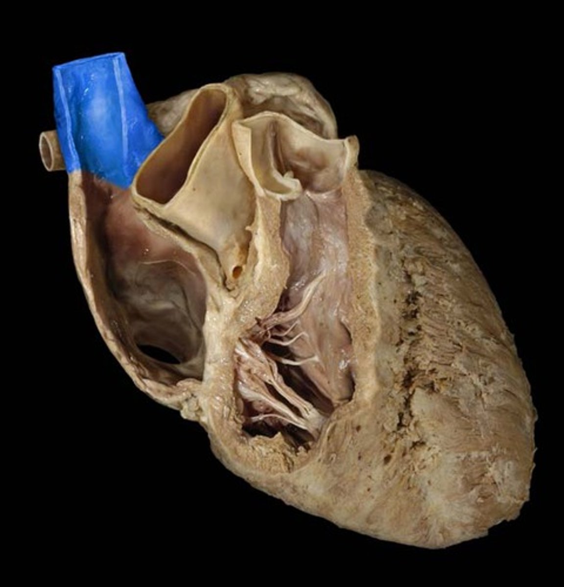 <p>Large vein carrying deoxygenated blood to heart.</p>