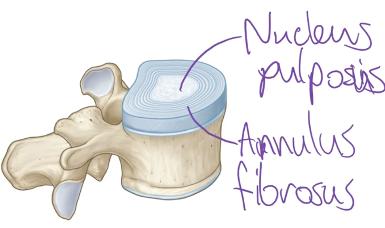 <p>-Discs that sit in between the vertebrae and connect the vertebrae in most of the spine </p>