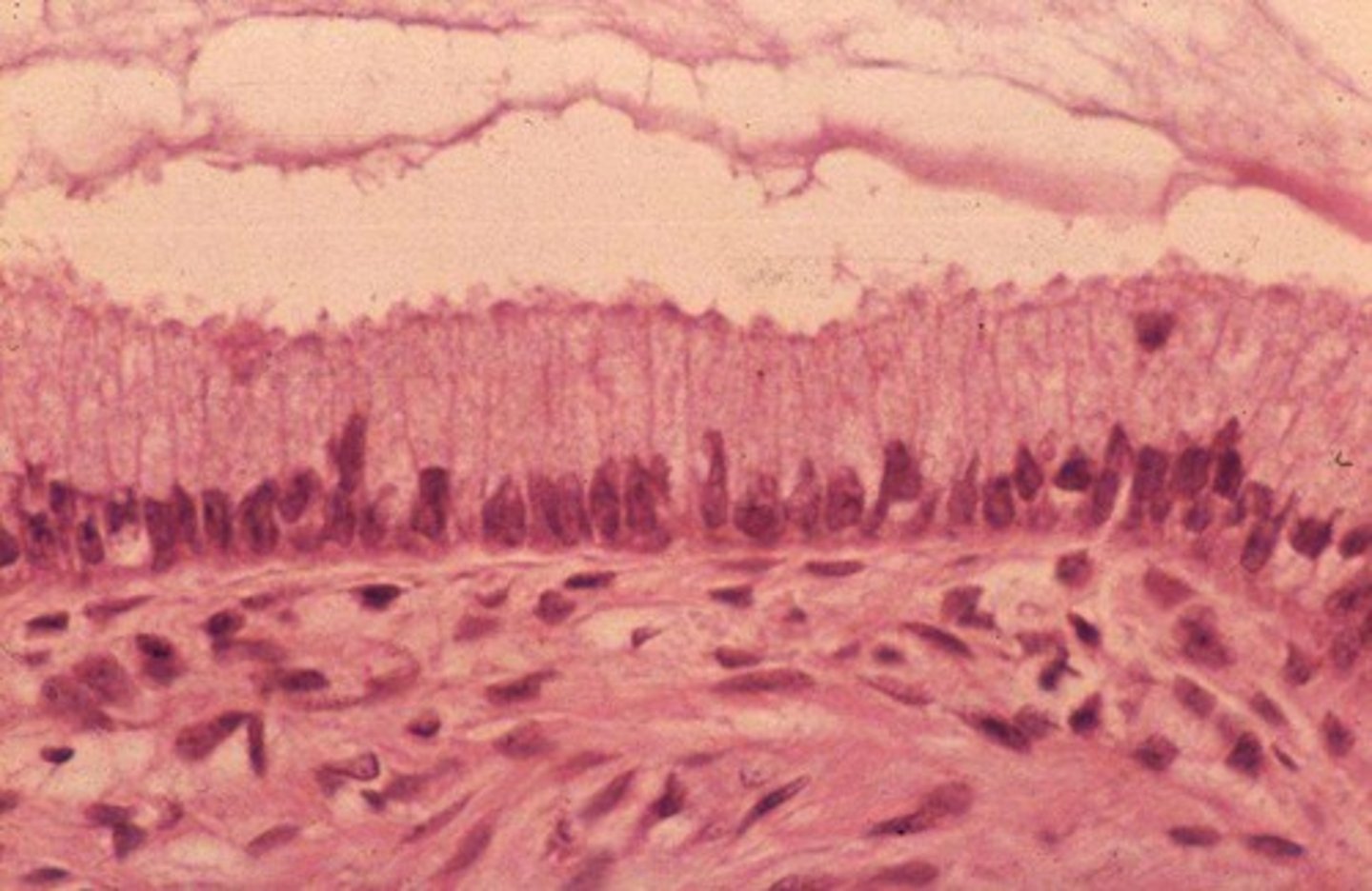 <p>Description: single layer of tall cells with oval nuclei; layer may contain mucus-secreting unicellular glands (goblet cells)</p><p>Function: absorption; secretion of music, enzymes, and other substances; ciliated type propels mucus (or reproductive cells) by ciliary action</p><p>Location: non-ciliated type of the digestive tract, the gallbladder, and excretory ducts of some glands ciliated type line small bronchi, uterine tubes, and some regions of the uterus</p>