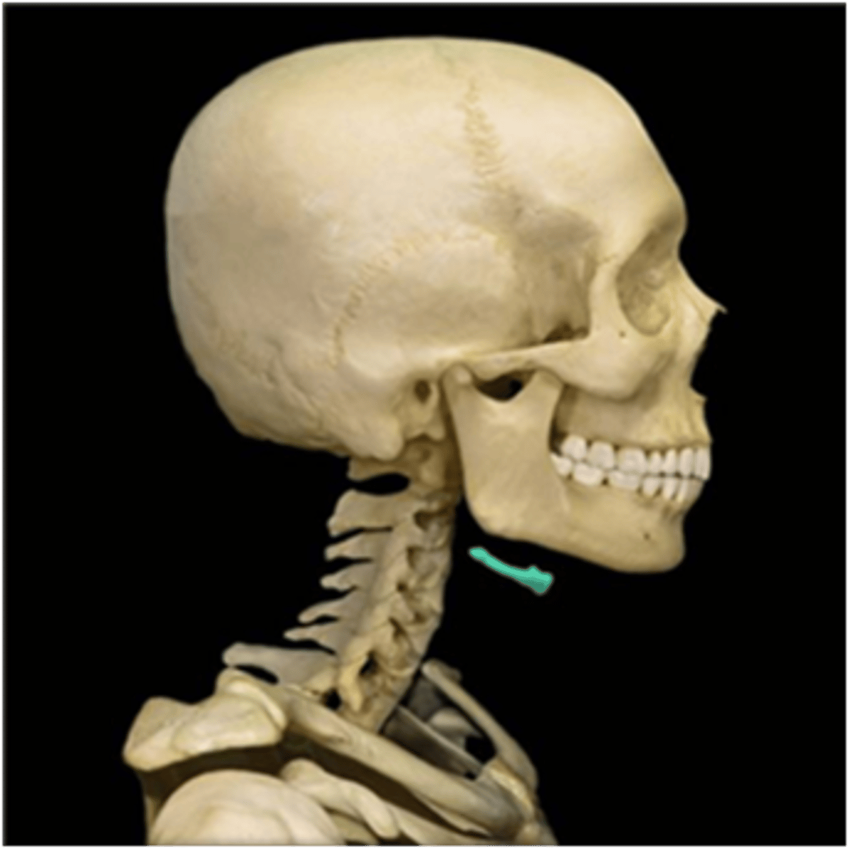 <p>attachs to the temporal bones and supports the base layer of the tounge</p>