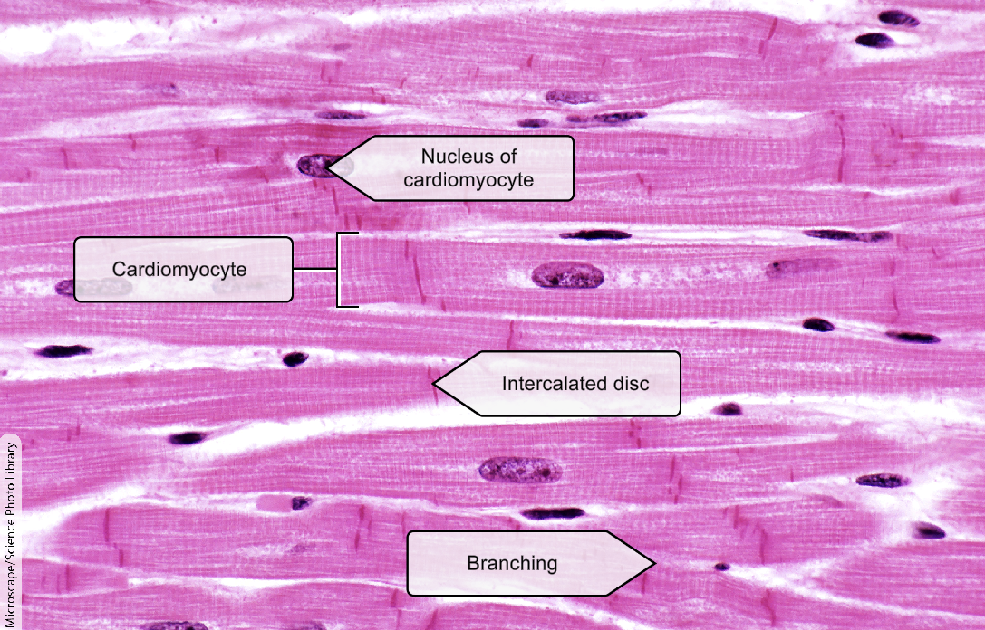 <p>Cardiomyocyte</p>