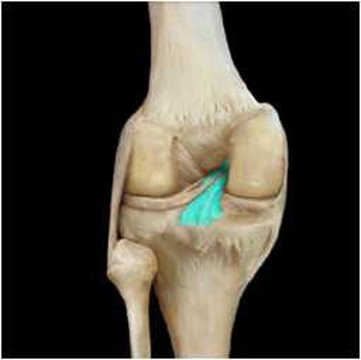 <p>Prevents the femur from sliding off the front of the tibia and prevents the tibia from being displaced backward.</p>