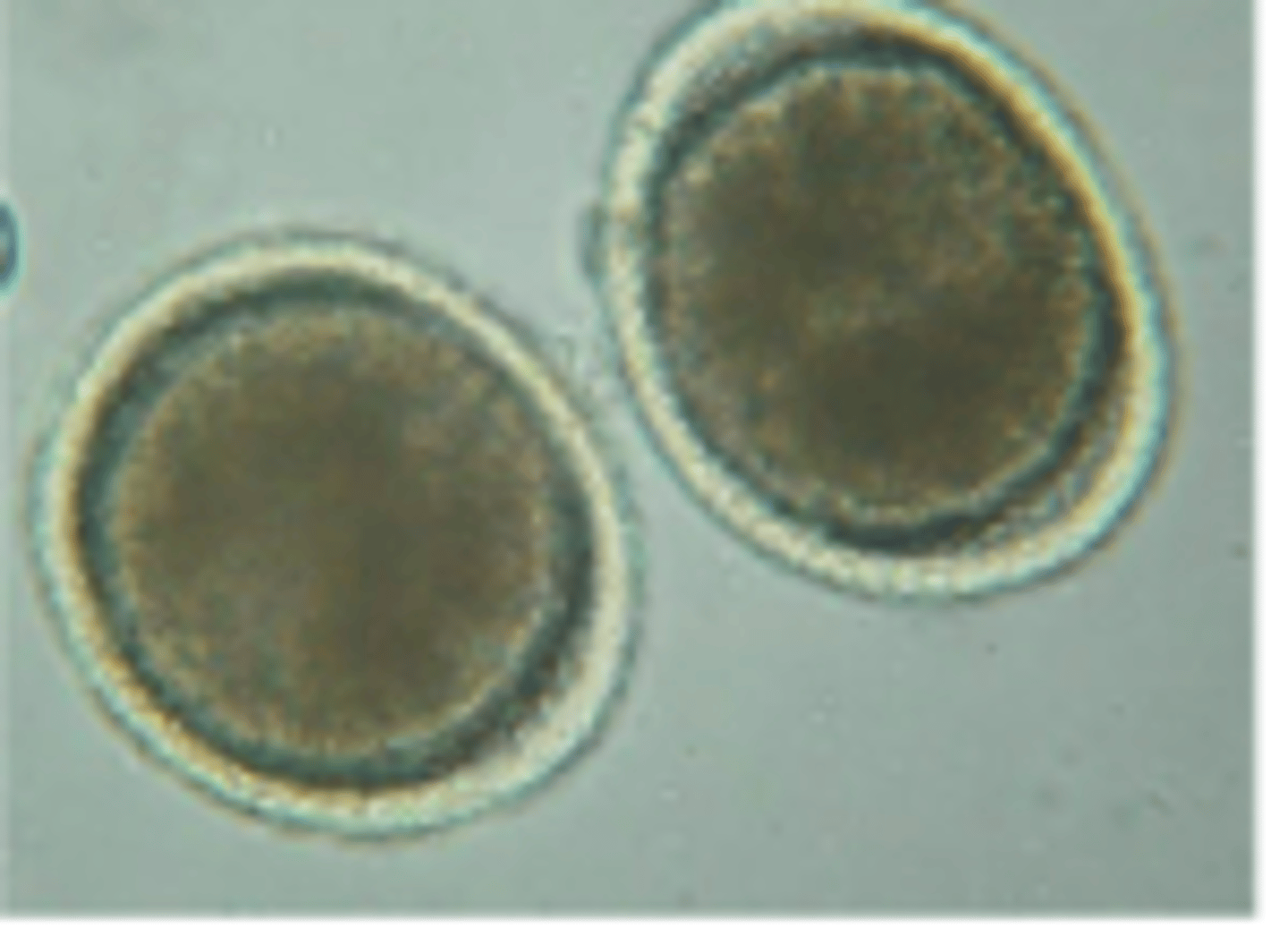 <p>Canine Roundworm</p><p>-Large stout worms</p><p>~7-18cm, females always larger, males smaller w/coiled tail</p>