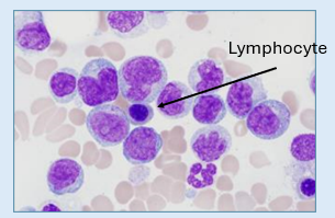 <p>Largest of the white blood cells with large purple, bean shaped nucleus </p>