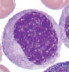 <p>Early stage looks very similar to the promyelocyte in size and nuclear characteristics except patches of grainy pale pink cytoplasm (secondary granules) becomes more evident near Golgi. Primary granule per cell decrease as cell divides and are less visible. Late stage are bit smaller than promyelocyte, nucleus more clumped, and nucleoli are difficult to see by light microscopy</p>
