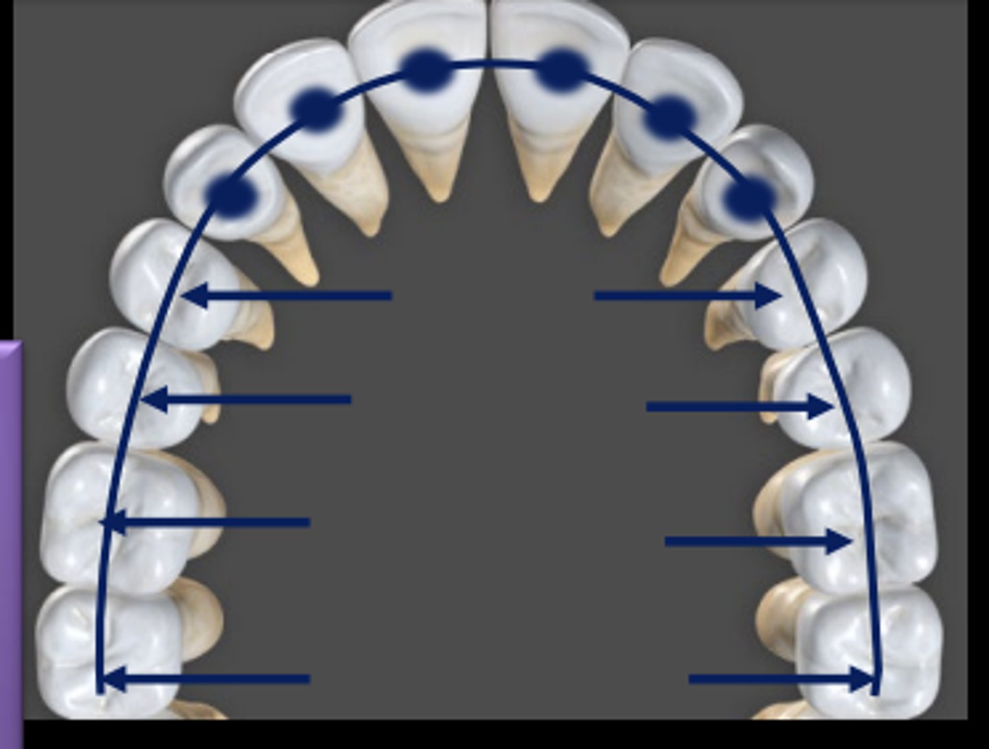<p>The central fossae of the molars and premolars</p><p>The lingual fossa of the canines and incisors</p>