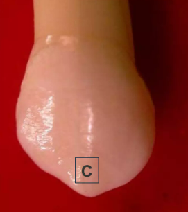 anterior tooth cusp