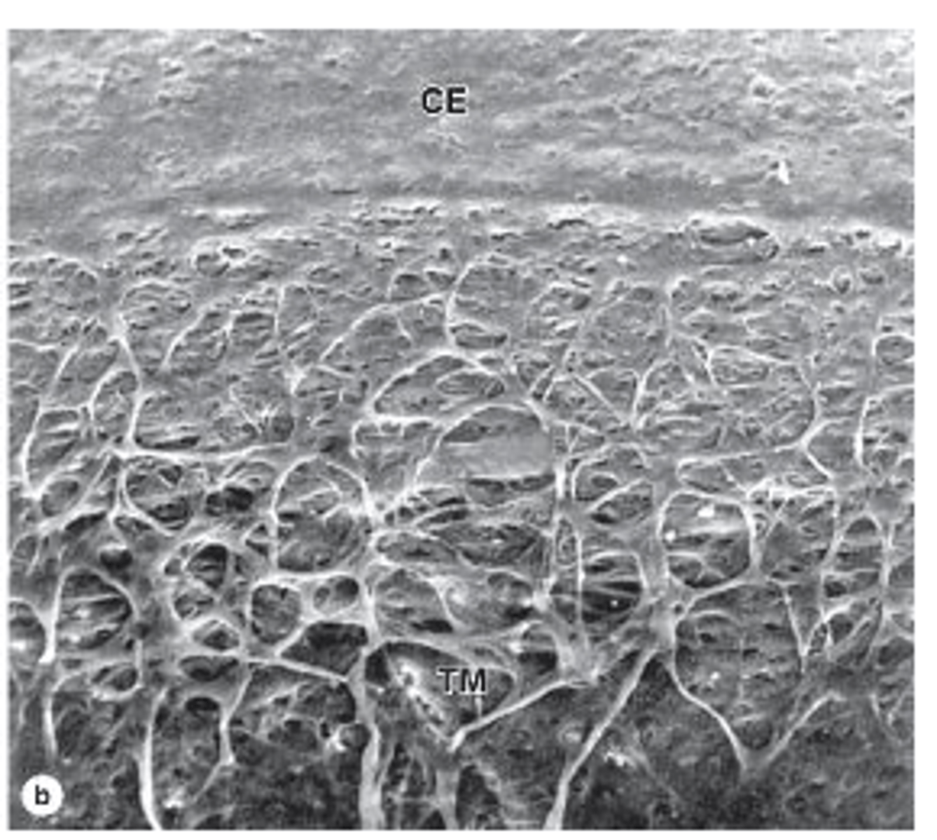 <p>Where does the trabecular meshwork penetrate?</p>