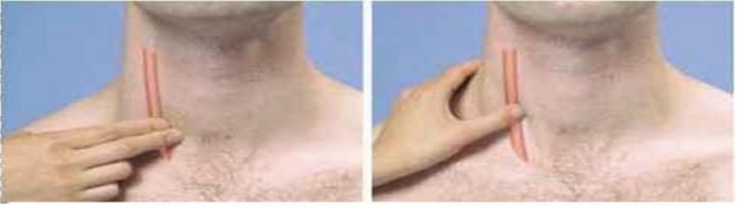 <p>Identify the pulse examined beside the larynx.</p>