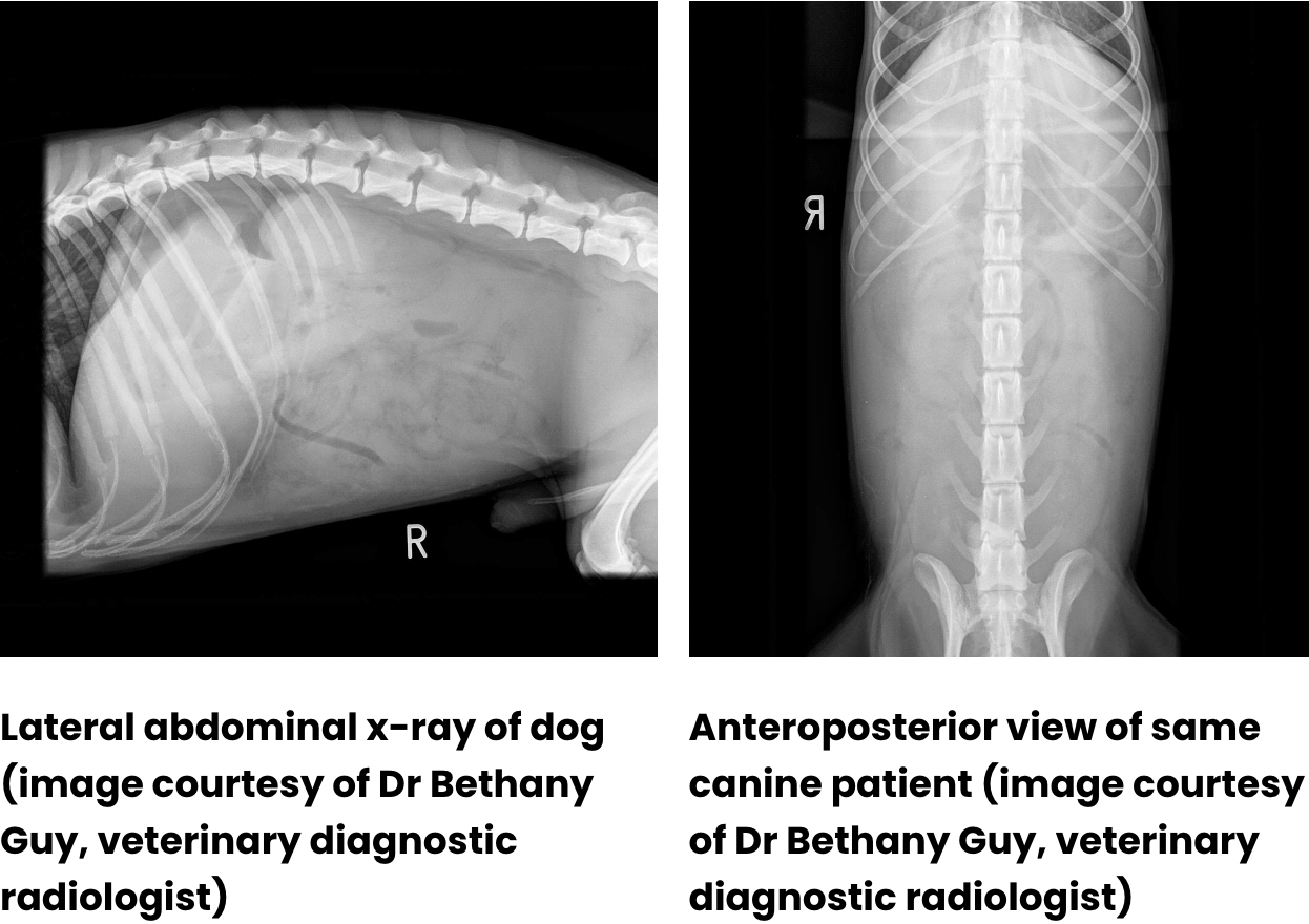 <p><span><span>This allows the air to be present at the top of the film, outlining the abdominal organs.</span></span></p>