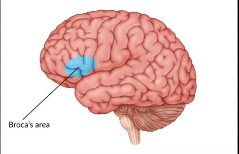 <p><mark data-color="#2a3d34" style="background-color: rgb(42, 61, 52); color: inherit;">Broca’s area</mark> is located in the frontal lobe. Damage to the area causes Broca’s aphasia, characterized<span> by hesitant and fragmented speech with little </span><u><span>grammatical</span></u><span> structure. Broca's area is primarily responsible for speech production.</span></p>