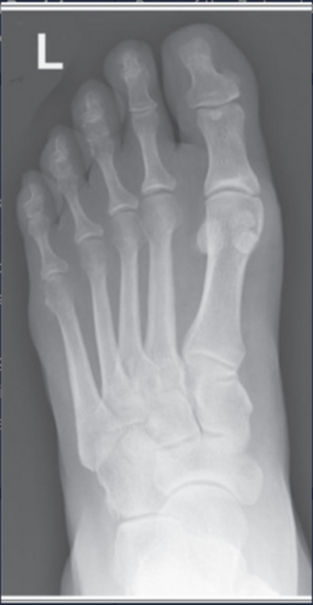 <p>Rotated laterally</p>