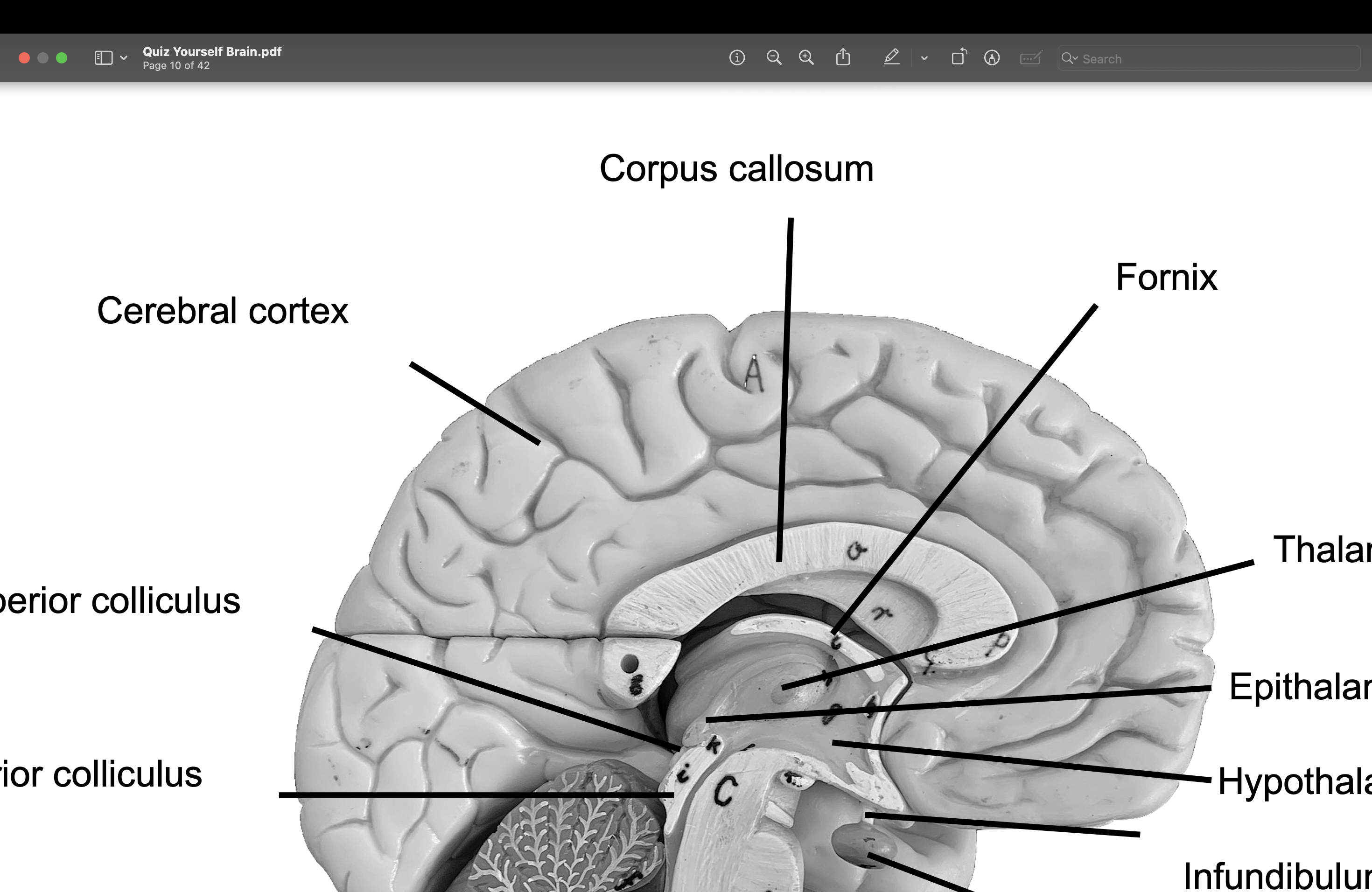 <p>Fornix</p>