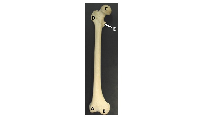 <p>What type of bone marking is A? (Hint: smooth rounded process in the inferior region)</p>