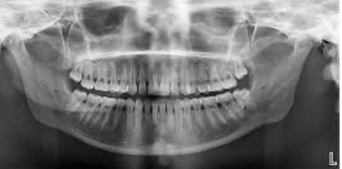 <p>mouth as a whole, less detailed </p>